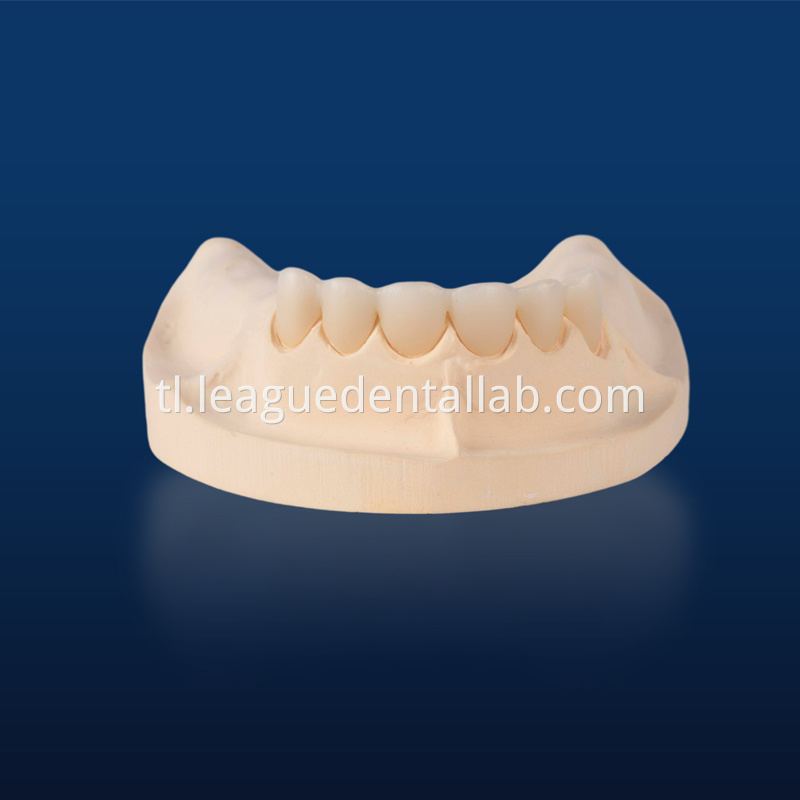 PFZ,Porcelain Fused to Zirconia,Zirconia Layered, Zirconia Veneered